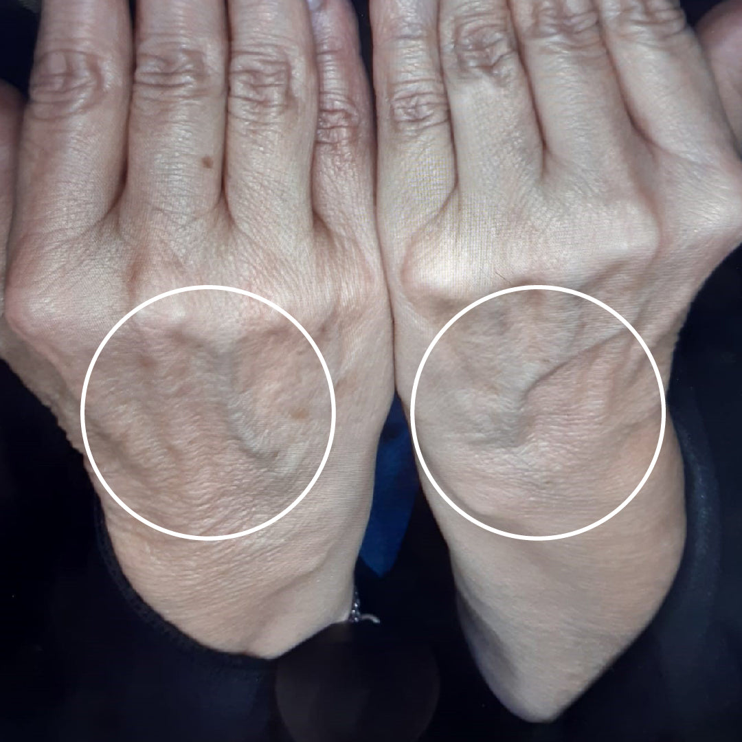 Firming + Complex